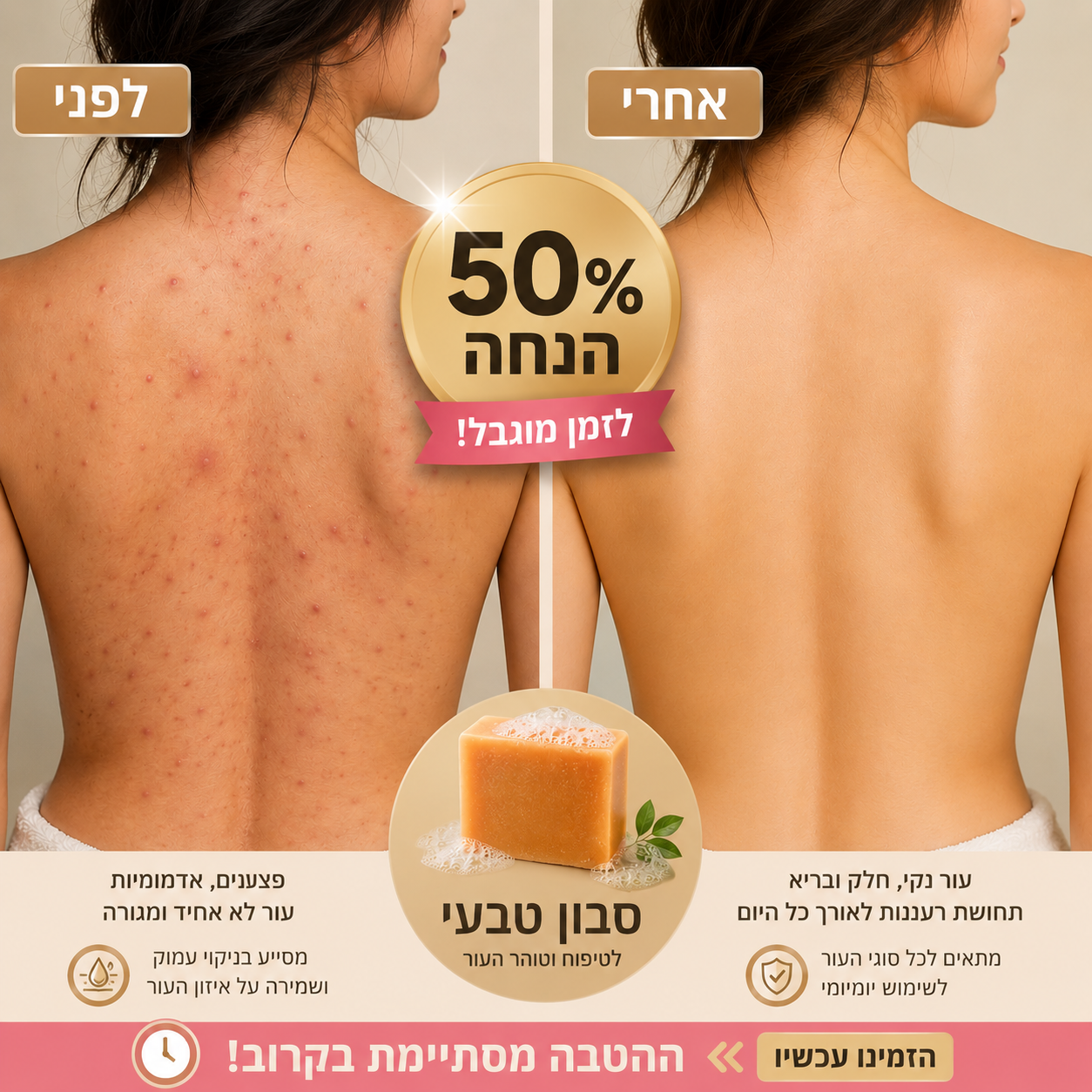 סבון כורכום בעבודת יד לסיוע העברת פצעונים וכהויות