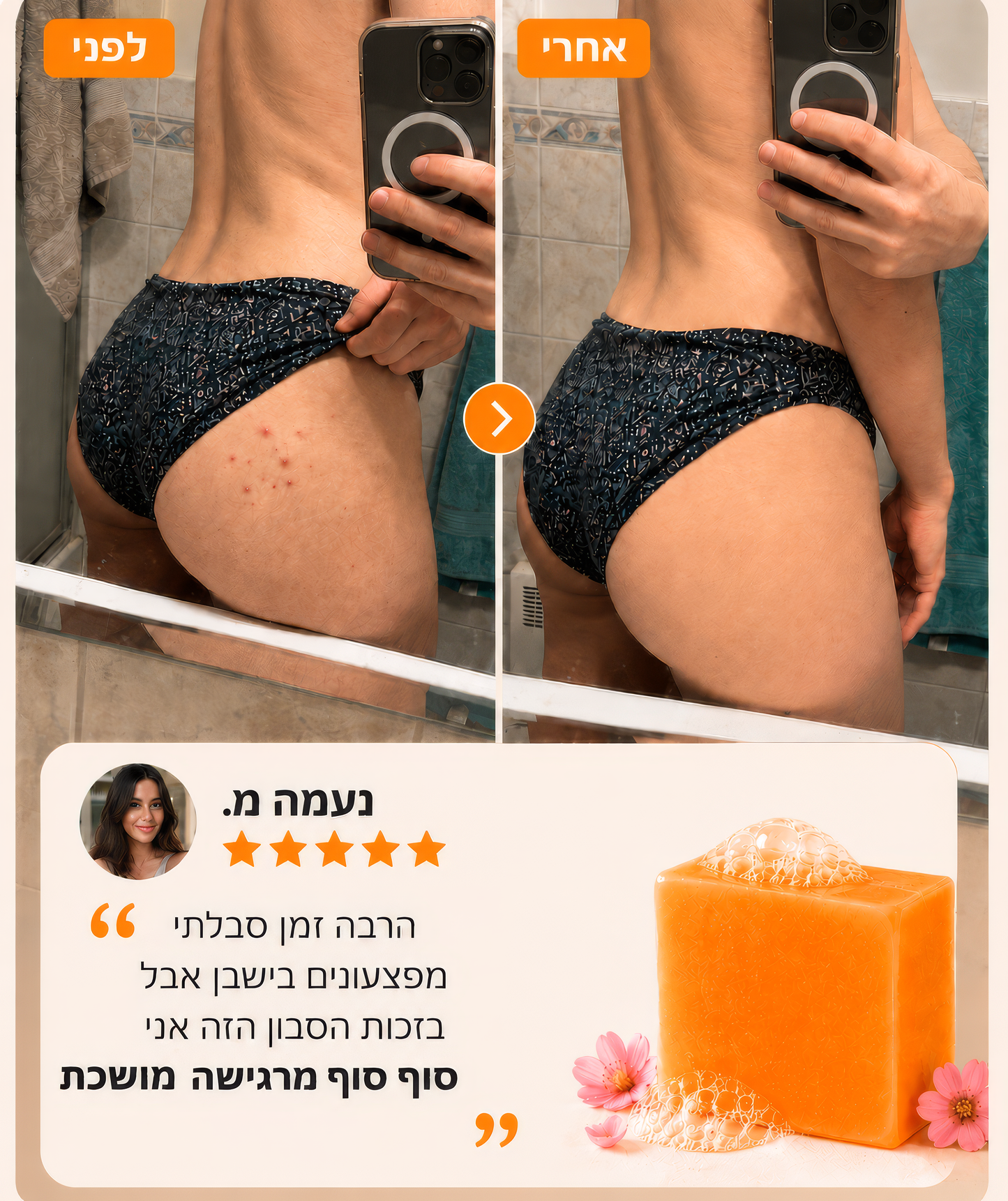 סבון כורכום בעבודת יד לסיוע העברת פצעונים וכהויות